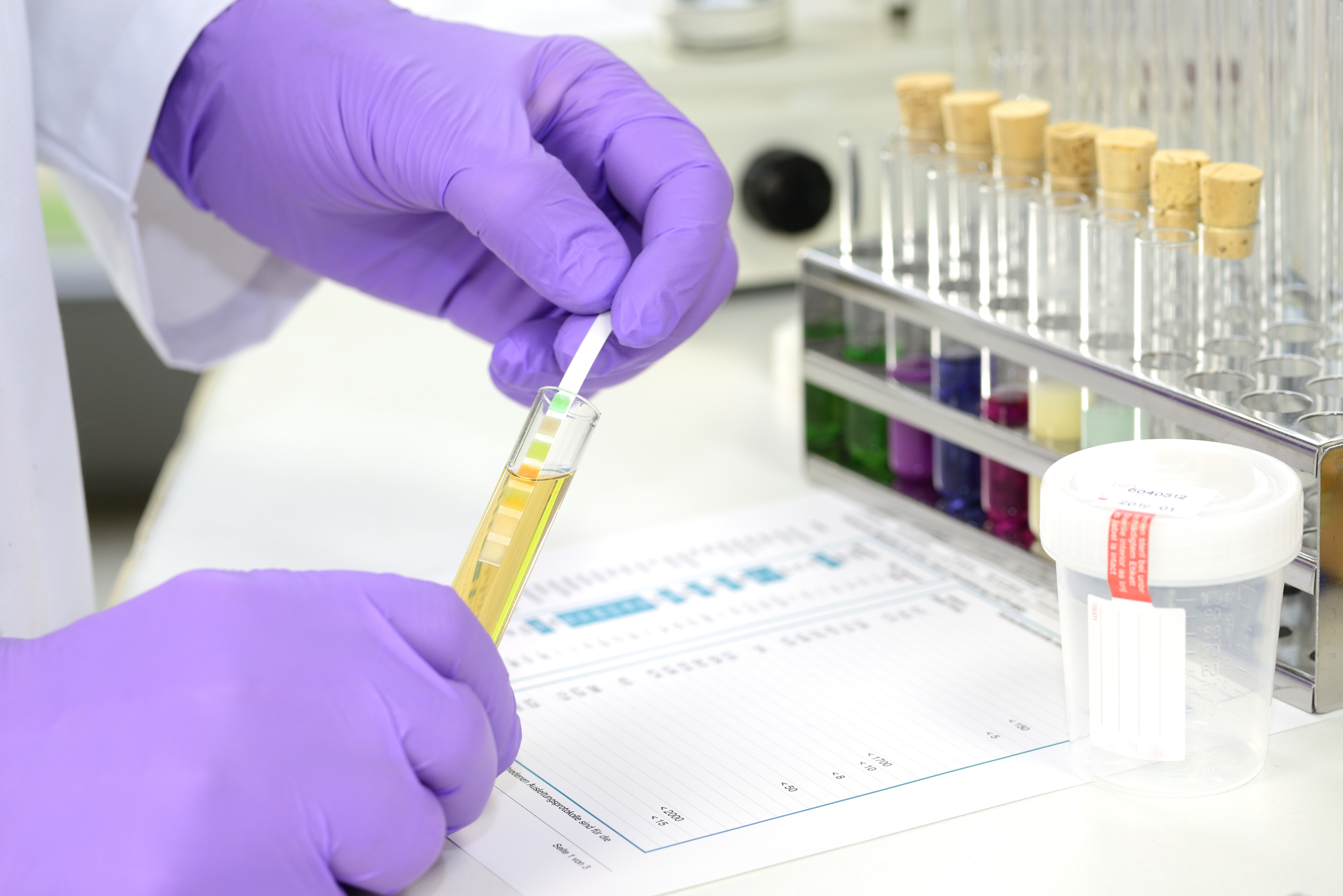 Ultrapure Water Standards: The Foundation of Reliable Lab Results